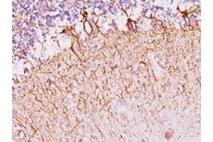 Immunohistochemical staining (Formalin-fixed paraffin-embedded sections) of human cerebellum with NEFH/NEFL monoclonal antibody, clone SPM145 . (NEFH antibody)