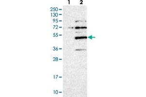 Western blot analysis of Lane 1: Negative control (vector only transfected HEK293T lysate), Lane 2: Over-expression Lysate (Co-expressed with a C-terminal myc-DDK tag (~3. (SERTAD4 antibody)