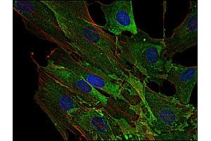 Immunocytochemistry (ICC) image for anti-AHNAK Nucleoprotein (AHNAK) (N-Term) antibody (ABIN302097)