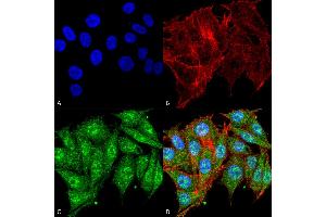 Immunocytochemistry/Immunofluorescence analysis using Rabbit Anti-IGF-1 Polyclonal Antibody . (IGF1 antibody  (HRP))