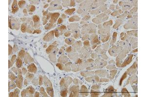 Immunoperoxidase of monoclonal antibody to ACADVL on formalin-fixed paraffin-embedded human heart. (ACADVL antibody  (AA 345-434))