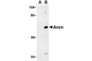 Western blot analysis of Aven in Raji cell lysate with AP30099PU-N Aven antibody at 1 μg/ml in (A) the presence and (B) the absence of blocking peptide. (AVEN antibody  (N-Term))