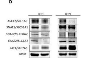 Glutamine dependency is increased but ASCT2 is dispensable in antiestrogen resistant breast cancer cells. (SLC38A2 antibody  (AA 21-150))