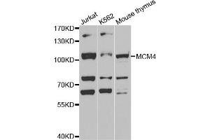 Western blot analysis of extracts of various cell lines, using MCM4 antibody (ABIN5971548) at 1:400 dilution.