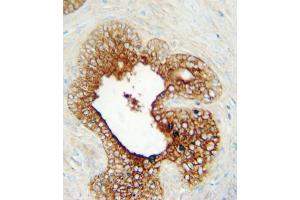 Immunohistochemistry (IHC) image for anti-Lymphocyte-Activation Gene 3 (LAG3) antibody (ABIN3002914) (LAG3 antibody)