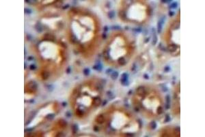 Used in DAB staining on fromalin fixed paraffin-embedded Kidney tissue (PKC zeta antibody  (AA 254-484))