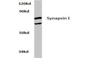 Western blot analysis of Synapsin-1 Antibody  in extracts from Hela cells at 1/500 dilution. (SYN1 antibody)