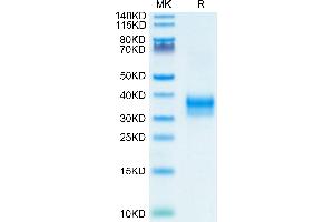 Mouse Siglec-15 on Tris-Bis PAGE under reduced condition. (SIGLEC15 Protein (AA 24-262) (His tag))