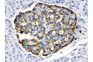 Immunohistochemistry (IHC) image for anti-Apolipoprotein B mRNA Editing Enzyme, Catalytic Polypeptide-Like 3G (APOBEC3G) (AA 191-384) antibody (ABIN4886468)