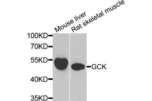 Western blot analysis of extracts of various cell lines, using GCK antibody (ABIN1980309) at 1:1000 dilution. (GCK antibody)