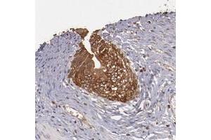 Immunohistochemical staining of human urinary bladder with SRRD polyclonal antibody  shows strong cytoplasmic positivity in urothelial cells. (SRRD antibody)