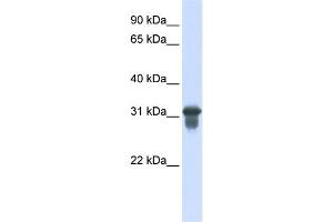 WB Suggested Anti-SLC25A11 Antibody Titration:  0.
