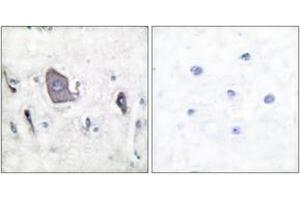 Immunohistochemistry analysis of paraffin-embedded human brain, using Trk B (Phospho-Tyr705) Antibody. (TRKB antibody  (pTyr706))