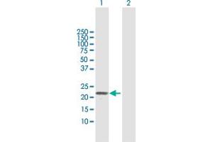 Western Blotting (WB) image for anti-Tumor Necrosis Factor Receptor Superfamily, Member 17 (TNFRSF17) (AA 1-184) antibody (ABIN513688)