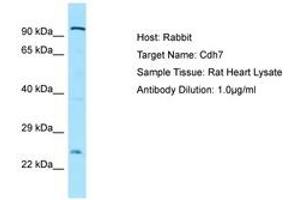 Image no. 1 for anti-Cadherin 7 (CDH7) (AA 51-100) antibody (ABIN6749910)