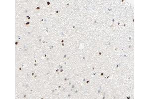 ABIN6266815 at 1/100 staining human brain tissue sections by IHC-P. (THRB antibody  (Internal Region))