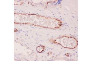 Anti-ACE Picoband antibody,  IHC(P): Human Placenta Tissue (Angiotensin I Converting Enzyme 1 antibody  (AA 651-864))
