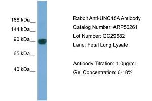 WB Suggested Anti-UNC45A  Antibody Titration: 0.