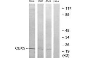 Western blot analysis of extracts from HeLa/A549/K562 cells, using CBX5 Antibody.