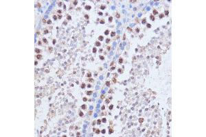 Immunohistochemistry of paraffin-embedded mouse testis using BRD4 antibody (ABIN6127508, ABIN6137653, ABIN6137654 and ABIN7101457) at dilution of 1:100 (40x lens). (BRD4 antibody  (AA 1100-1200))