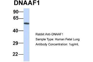 Host: Rabbit  Target Name: DNAAF1  Sample Tissue: Human Fetal Lung  Antibody Dilution: 1. (LRRC50 antibody  (N-Term))