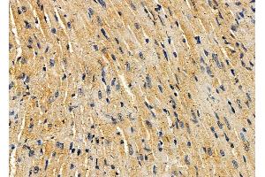 ABIN7094996 and ABIN7099052 at 1/100 staining mouse heart tissue by IHC-P.