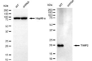 Western blotting analysis using TIMP2 antibody (ABIN7799377).