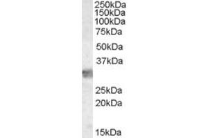 Western Blotting (WB) image for anti-Myeloid Differentiation Primary Response Gene (88) (MYD88) (Internal Region) antibody (ABIN2465254) (MYD88 antibody  (Internal Region))