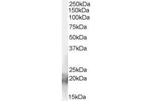 ABIN185618 (2µg/ml) staining of Human Muscle lysate (35µg protein in RIPA buffer). (CNBP antibody  (C-Term))