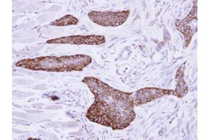 IHC-P Image Immunohistochemical analysis of paraffin-embedded H661 xenograft, using MCD, antibody at 1:500 dilution. (MLYCD antibody)