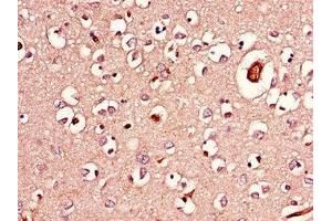 Immunohistochemistry of paraffin-embedded human brain tissue using ABIN7143254 at dilution of 1:100 (Acylglycerol Kinase antibody  (AA 32-65))