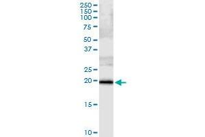 Immunoprecipitation of SSH2 transfected lysate using anti-SSH2 MaxPab rabbit polyclonal antibody and Protein A Magnetic Bead , and immunoblotted with SSH2 MaxPab mouse polyclonal antibody (B01) . (SSH2 antibody  (AA 1-178))