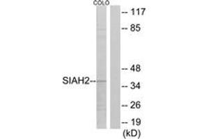 Western blot analysis of extracts from COLO cells, using SIAH2 Antibody.