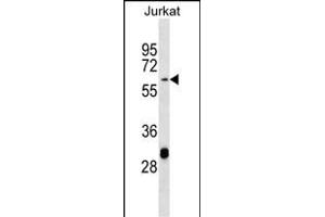 TN3 Antibody (Center) (ABIN656882 and ABIN2846082) western blot analysis in Jurkat cell line lysates (35 μg/lane). (Matrilin 3 antibody  (AA 220-248))