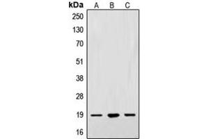 Western blot analysis of Alpha-synuclein expression in A549 (A), SKNSH (B), PC12 (C) whole cell lysates. (SNCA antibody  (N-Term))