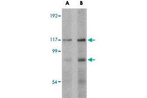 Western blot analysis of FNIP2 in rat skeletal muscle tissue lysate with FNIP2 polyclonal antibody  at (A) 1 and (B) 2 ug/mL . (FNIP2 antibody  (C-Term))