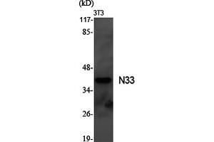 Western Blotting (WB) image for anti-Tumor Suppressor Candidate 3 (TUSC3) antibody (ABIN5961746) (TUSC3 antibody)