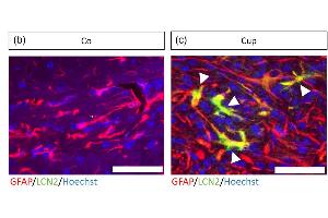 Immunohistochemistry (IHC) image for anti-Lipocalin 2 (LCN2) (AA 21-200) antibody (ABIN7433591)