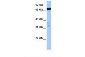 Image no. 1 for anti-Zinc Finger Protein 340 (ZNF340) (N-Term) antibody (ABIN6739296) (ZBTB46 antibody  (N-Term))