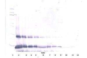 Image no. 1 for anti-Interleukin 15 (IL15) antibody (ABIN465267) (IL-15 antibody)