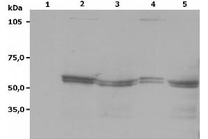 Western Blotting analysis (non-reducing conditions) of Lyn using anti-Lyn (LYN-01). (LYN antibody  (AA 8-238))