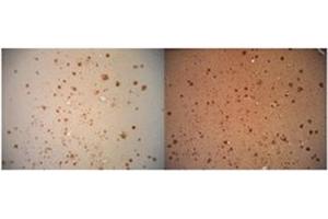 Immunohitsochemistry analysis of Amyloid Fibrils (OC) in Human AD brain, showing no Amyloid Precursor Protein (APP) cross-reactivity (Left), but when conducted with monoclonal 6E10 (Right) shows considerable APP cross-reactivity. (Amyloid Fibrils antibody)