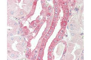 Anti-CELF3 antibody IHC staining of human kidney.