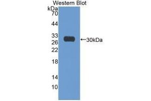 Detection of Recombinant Ki67P, Human using Monoclonal Antibody to Ki-67 Protein (Ki-67) (Ki-67 antibody  (AA 3088-3235))