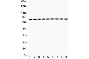 Western blot testing of Plakoglobin antibody and Lane 1:  rat brain;  2: (r) heart;  3: (r) thymus;  4: (r) RH35;  5: human HeLa;  6: (h) COLO320;  7: (h) HepG2;  8: mouse HepA;  9: (h) MCF-7. (JUP antibody  (AA 556-745))