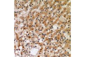 Immunohistochemistry (IHC) image for anti-Tumor Necrosis Factor Receptor Superfamily, Member 11a, NFKB Activator (TNFRSF11A) (N-Term) antibody (ABIN7304526)