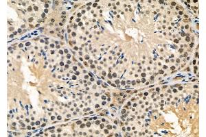 ABIN6258658 and ABIN6274958 at 1/100 staining Mouse testis tissue by IHC-P.