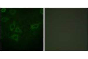 Immunofluorescence (IF) image for anti-Thymidine Kinase 1, Soluble (TK1) (AA 1-50) antibody (ABIN2888706) (TK1 antibody  (AA 1-50))