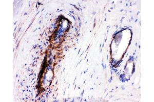 Anti-LASP1 antibody,  IHC(P) IHC(P): Human Placenta Tissue (LASP1 antibody  (N-Term))