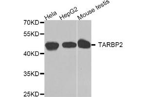 Western blot analysis of extracts of various cell lines, using TARBP2 antibody (ABIN5974736) at 1/1000 dilution.